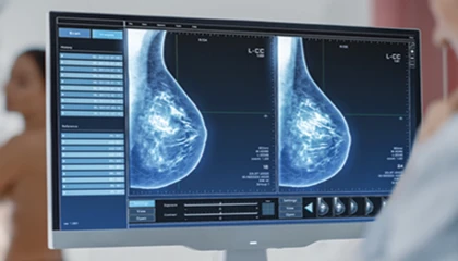 “Mamografi erken tanı ve tedavi için önemli”