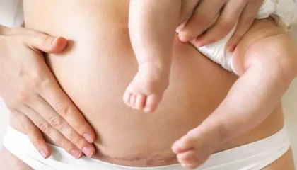 Sezaryen mi, normal doğum mu? Uzmanlar farklı bakış açılarıyla değerlendirdi