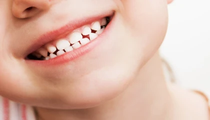 Diş sıkma alışkanlığı olan çocuklarda nelere dikkat edilmeli?