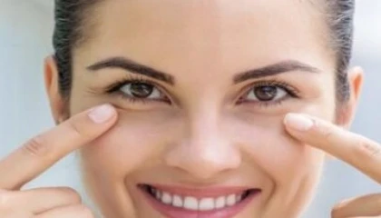 Göz altı torbaları gençler de görülüyor!