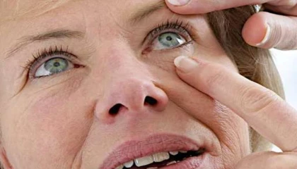 Göz kapağı hastalıklarına dikkat!