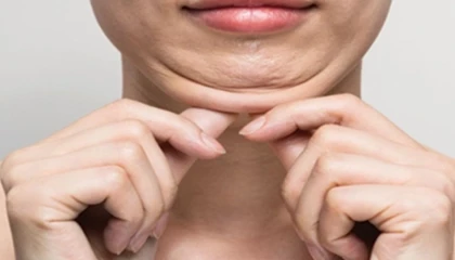 Keşanlı 3 dermatolog, Tiflis’teki Dermavizyon toplantısında buluştu