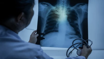 Uzm. Dr. Kılıçlı: Zatürre toplum sağlığı için büyük tehdit