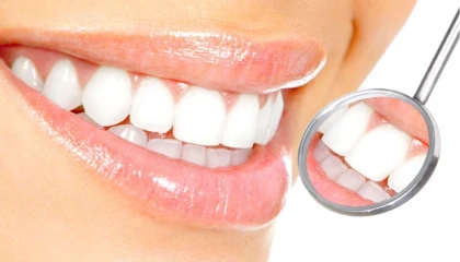 Diş beyazlatmada doğru bilinen yanlışlar!